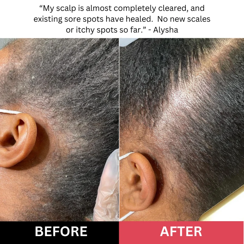 ✨ Clarifying Scalp Scrub – Exfoliate, Refresh & Remove Buildup