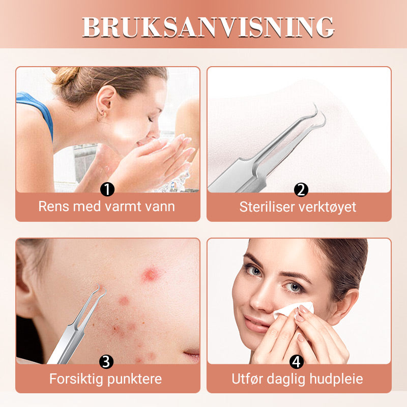 💓💥Blackhead Remover Pimple Extractor Tool Kit